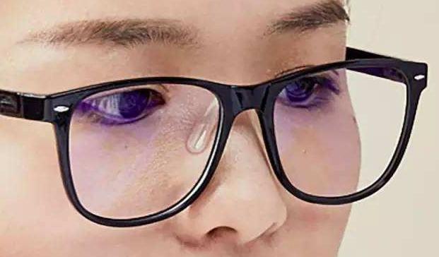 为什么鼻梁上有小红点,为啥戴眼镜鼻子上有印