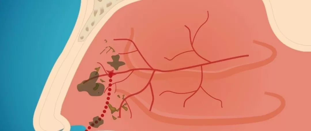 我有十指，爱挖鼻屎