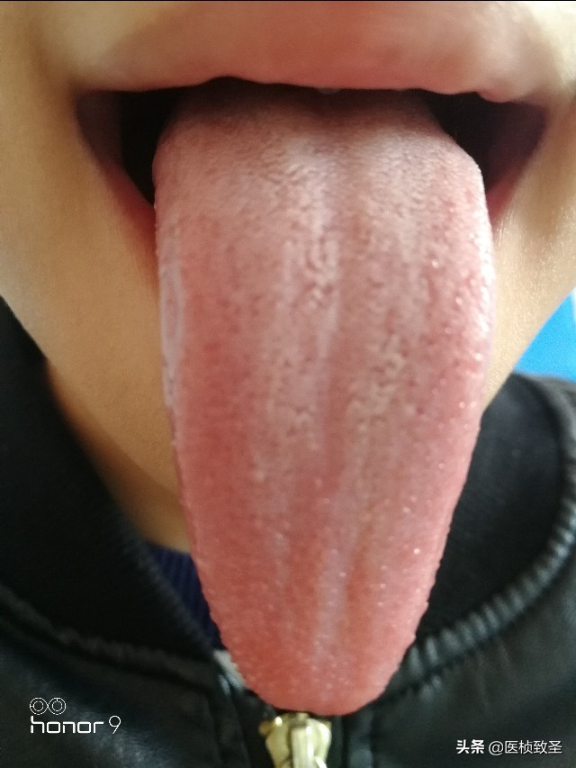 胃病调理好的真实案例,胃病调理真实案例