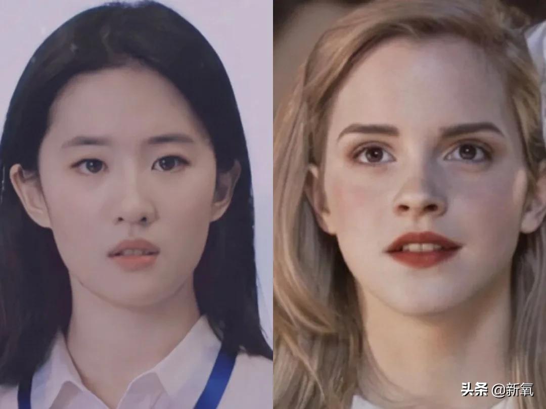 做双眼皮的姐妹还是要慎重,姐妹们你们割双眼皮多少钱