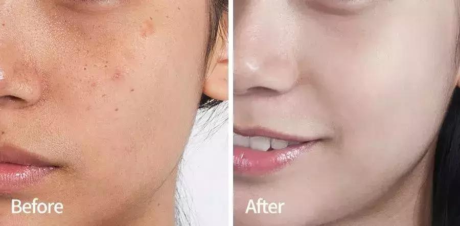 韩国小灯泡美白精华怎么样,韩国小灯泡精华抗皱效果