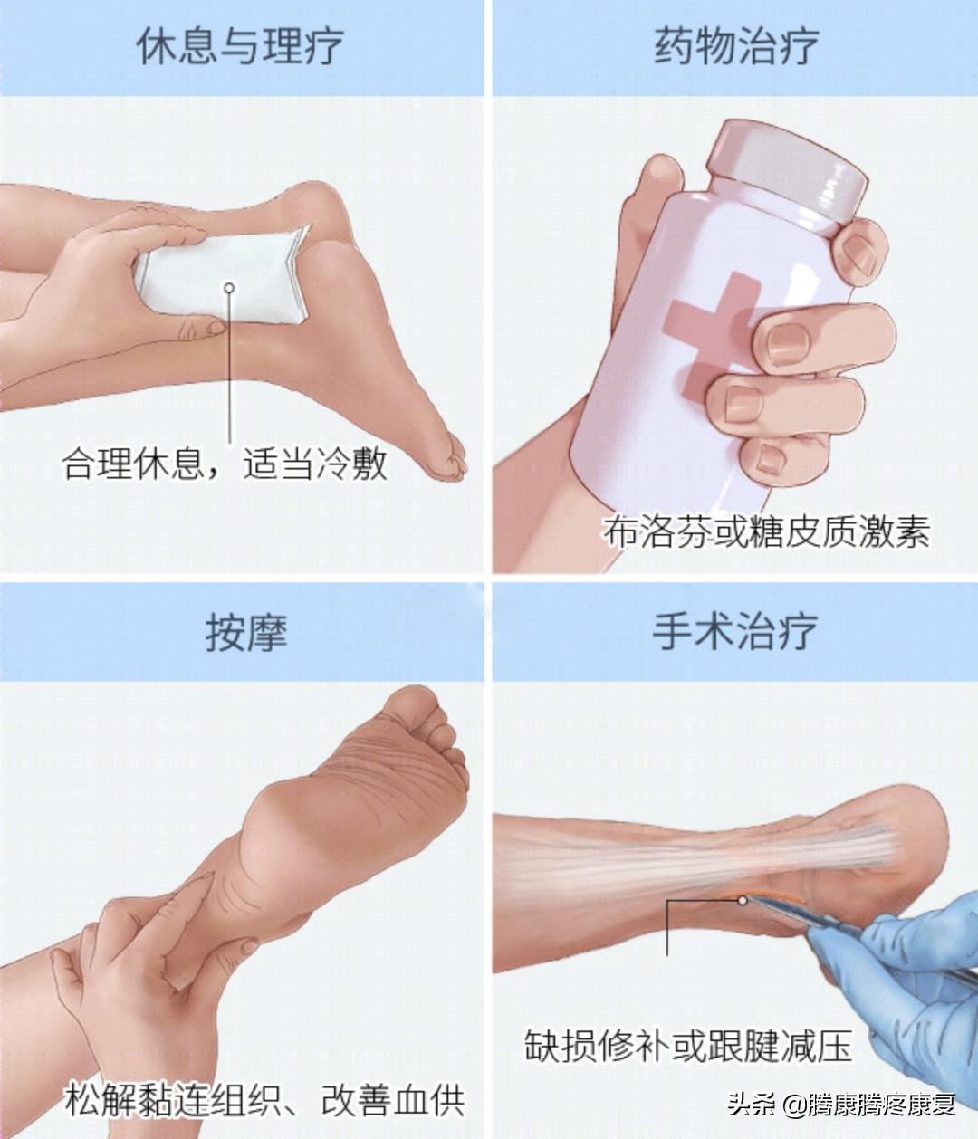 跟腱炎临床诊疗指南,跟腱炎起因和治疗