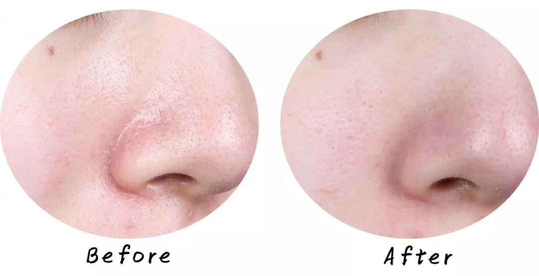 十大清洁面膜排行榜混合性皮肤,十大好用清洁面膜