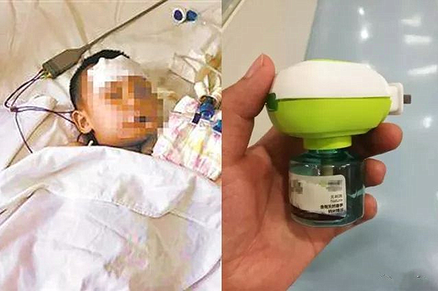 4岁女童误吞一角硬币怎么处理,4岁女童误吞5角硬币