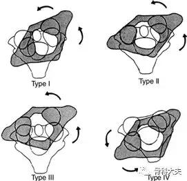脖子突然往一边歪是怎么回事,孩子脖子突然歪了怎样矫正