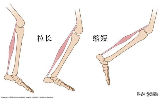 慢跑很累怎么办,慢跑久了有点心塞