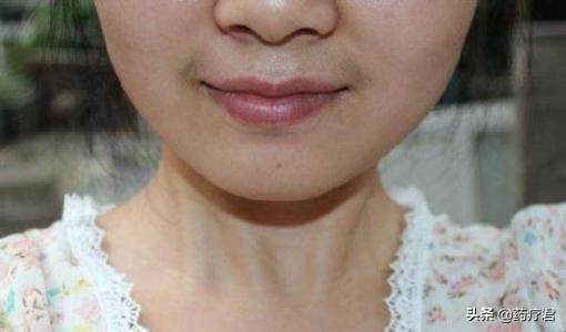 为什么女生嘴唇上面胡子越来越少,女生嘴唇为何长胡子