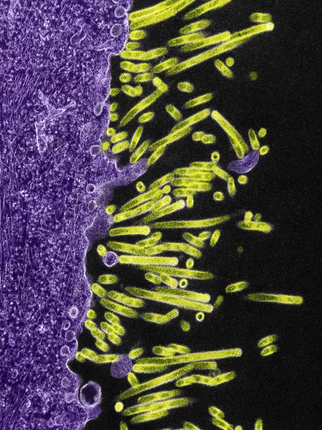 感染病毒后的168小时,你的体内都发生了什么?
