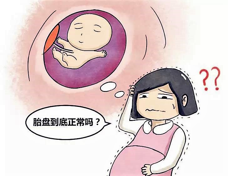 前置胎盘的主要护理诊断是什么,前置胎盘剖腹产要几个医生