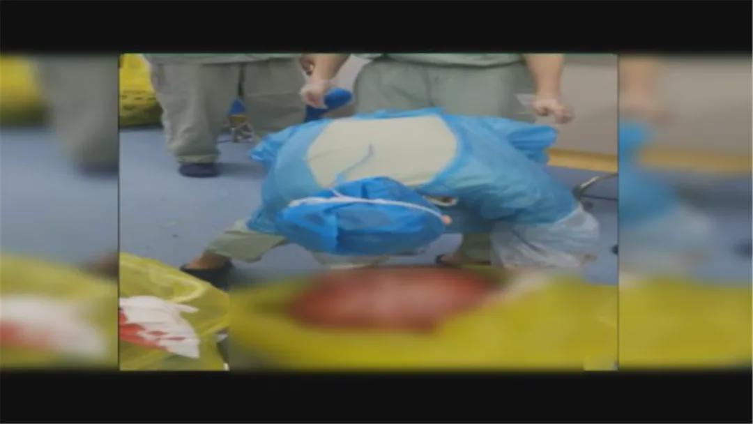 女子腹中取100斤重肿瘤,年轻女子查出大肌瘤