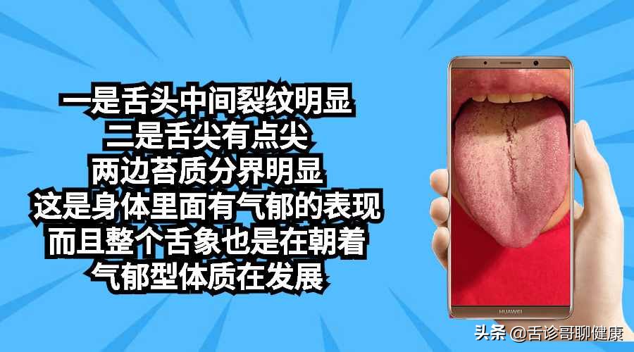 舌诊歌舌象分析与感悟,舌诊哥聊健康痰湿