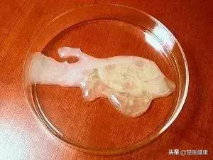 生殖科医生讲述：我在取精室里的秘密……