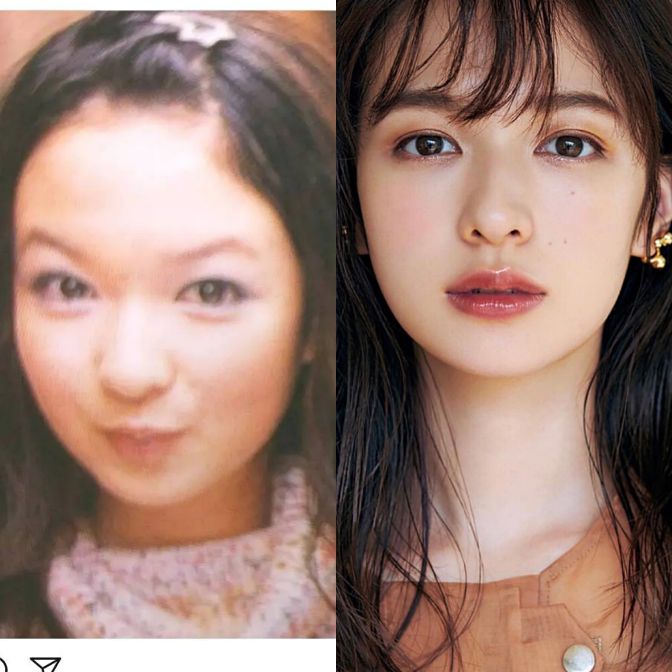 日本整容惊人案例,日本整容是不是最先进