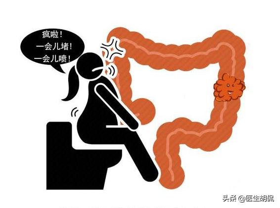 大便擦不干净是肠癌吗,上大号老是感觉排不干净擦不干净