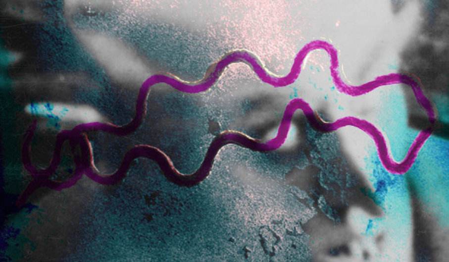 这个臭名昭著的性病，治好了仍会终生阳性？