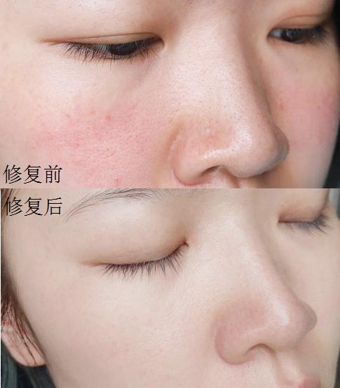 换季护肤面霜大牌,换季护肤大作战视频