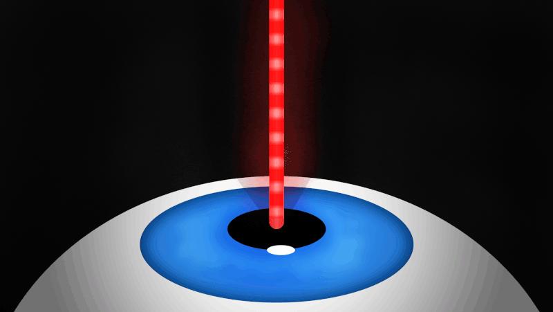 近视眼激光手术十大危害,近视眼手术真安全吗文章