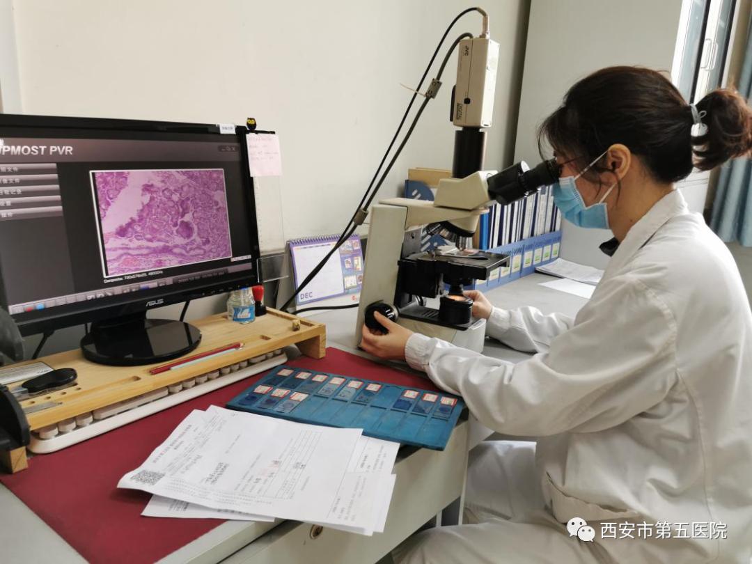 穿刺病理分析为什么那么慢,快病理和慢病理有啥区别