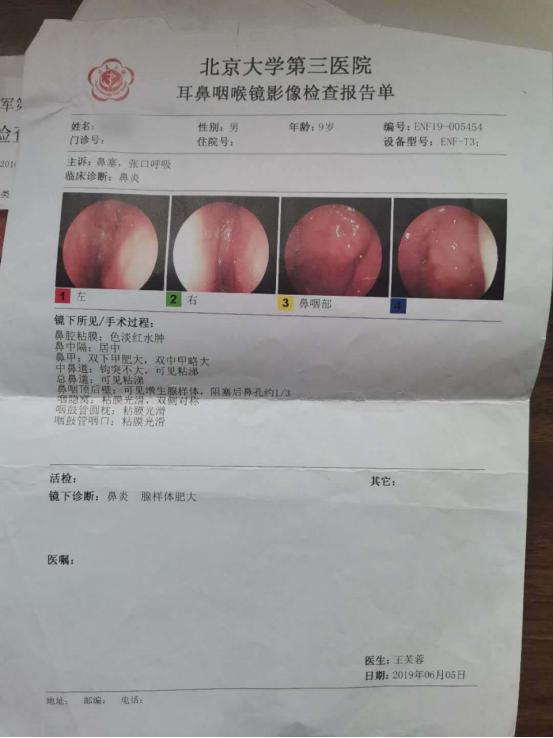 2岁宝宝脾胃虚拉肚子大便不成型,孩子腹泻一直没精神