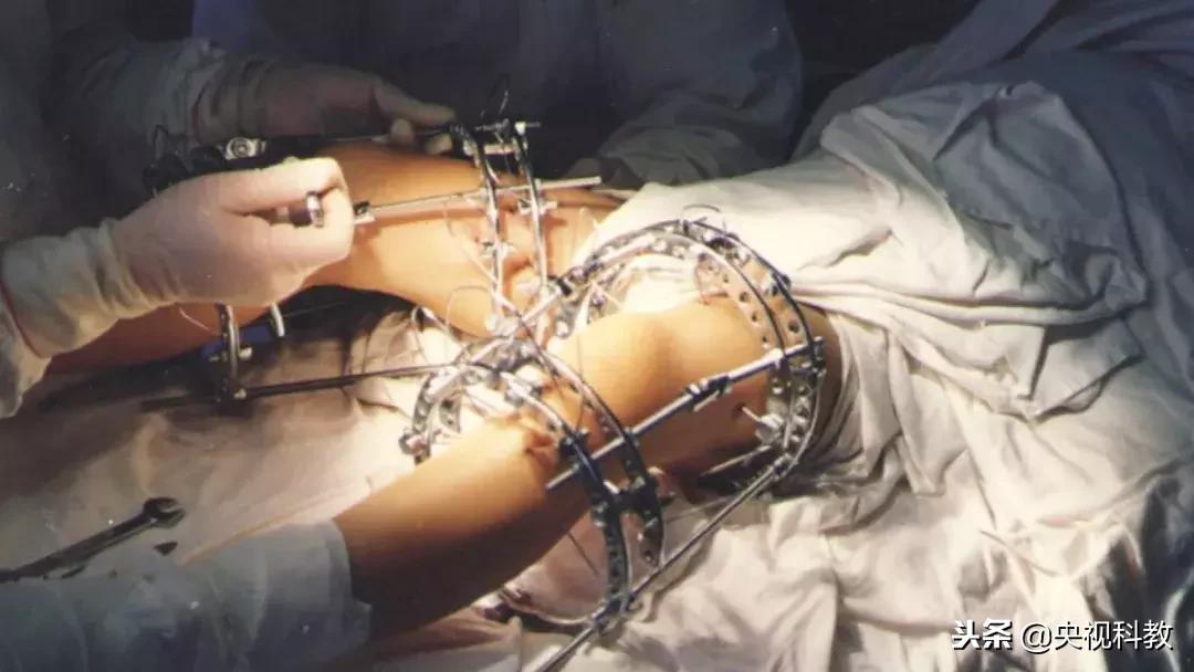 北京儿童医院西院骨科专家,北京儿童医院儿科骨科专家都有谁