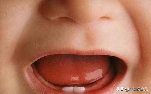 为什么七个月宝宝还没长牙齿,为什么宝宝快一岁还没有长牙