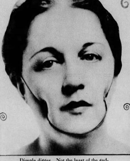 人造酒窝值得做吗,人造酒窝能坚持几年