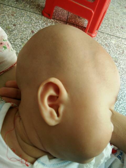 婴儿头型怎么定型好看,婴儿头型怎么睡才是正常头型