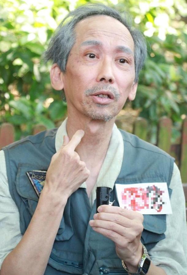 张达明瘫痪电影,张达明周星驰