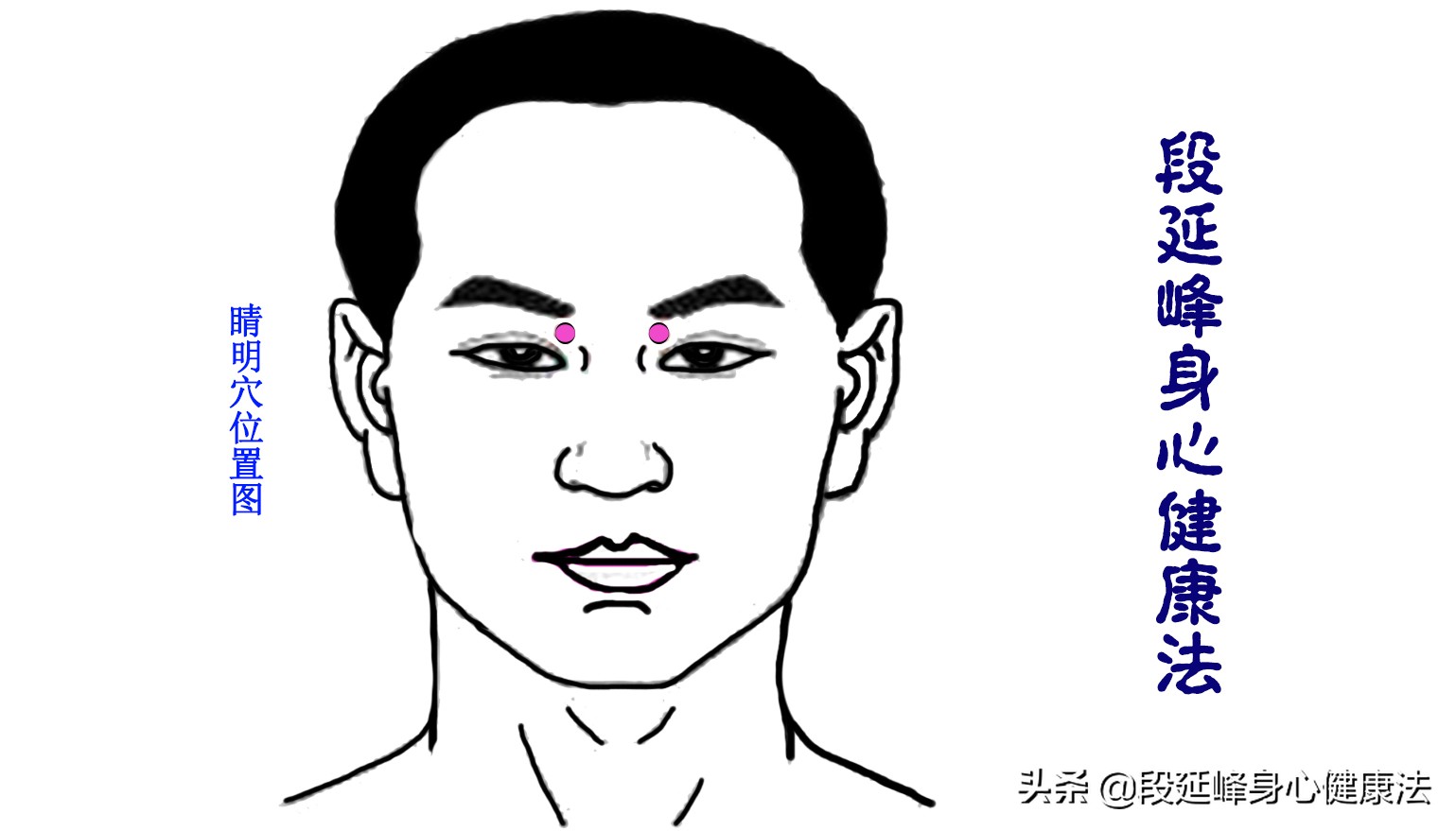 严重黑眼圈可以逆转吗,延峰治疗黑眼圈