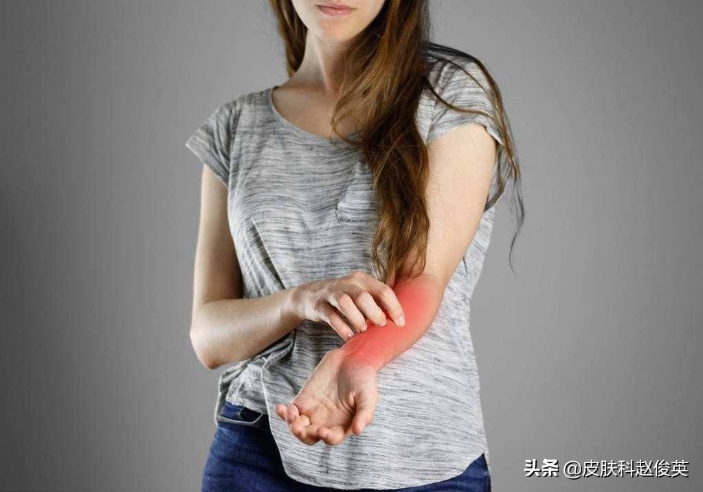 神经性皮炎为什么会皮肤起癣痒,顽固神经性皮炎如何感染的