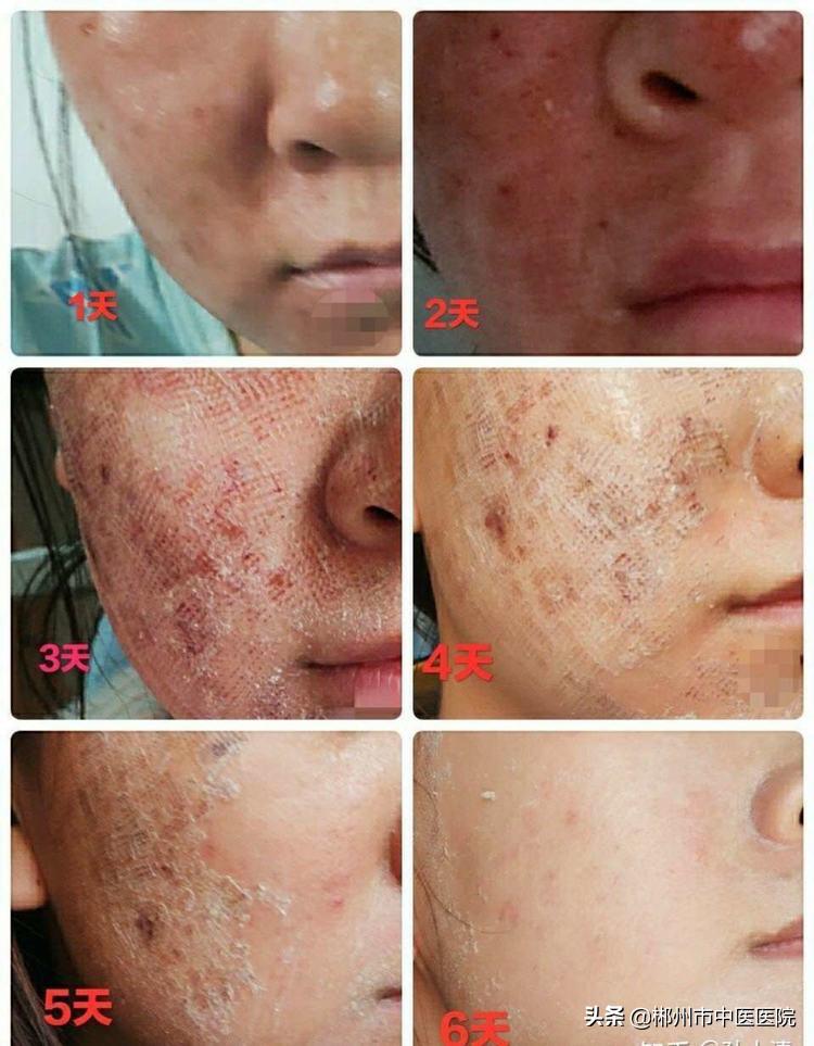 神奇的橡皮擦完整版,神奇的橡皮擦完整视频