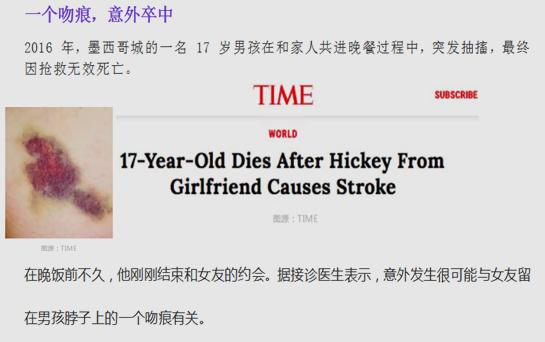 一个吻痕引起的致命性脑梗死事件，医生为你图说其中的机制