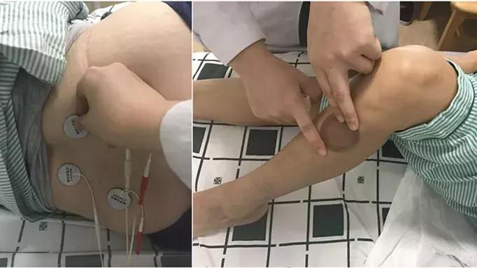 中医对子宫肌瘤的认知,吃重楼对子宫肌瘤有用吗