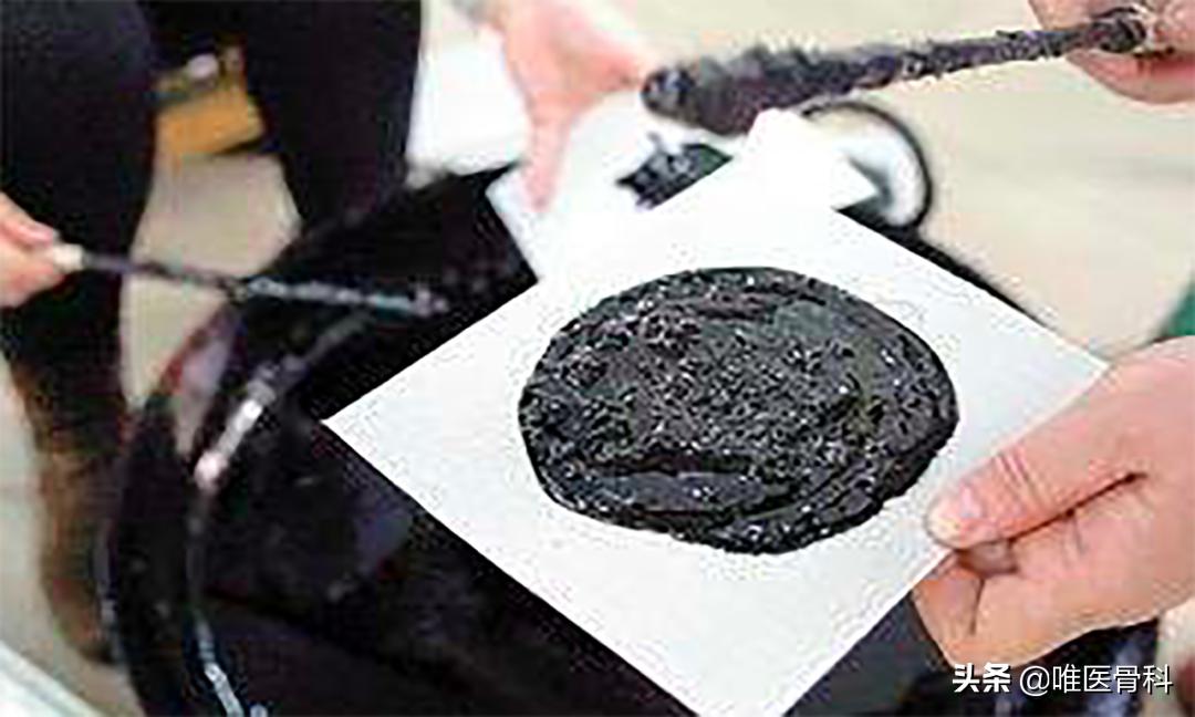 腰酸背痛千万别用膏药,腰酸背痛就贴膏药