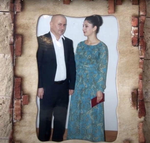 抽脂减肥成了植物人,整形抽脂死亡