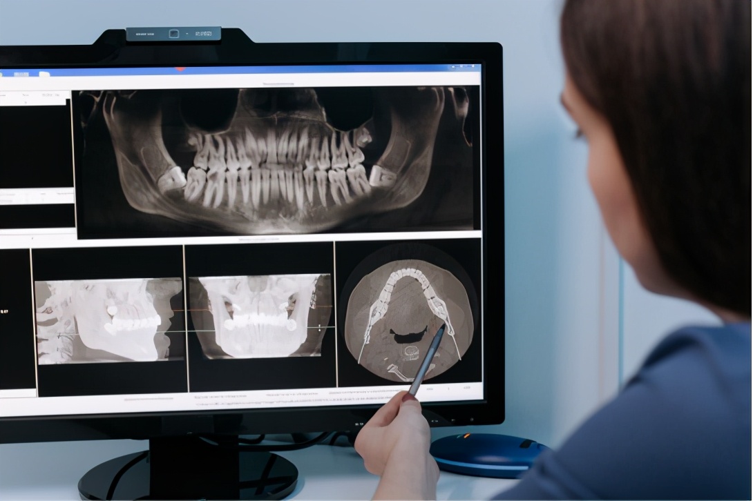 正畸过程记录,牙齿正畸过程记录