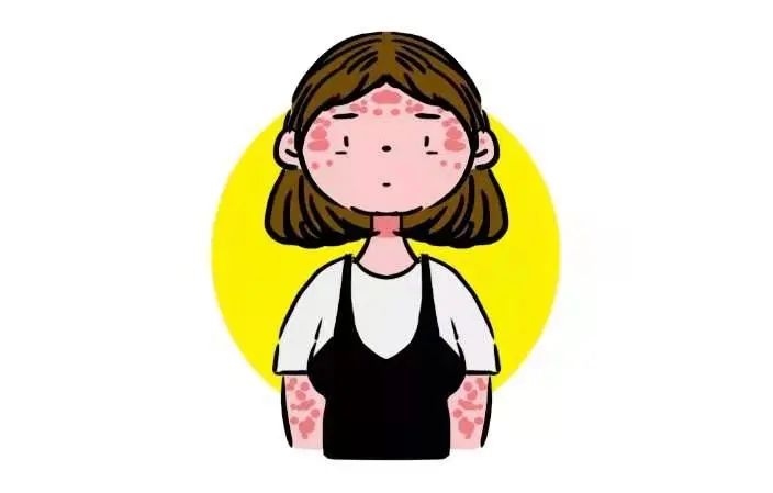 头皮型银屑病偏方,银屑病偏方土茯苓