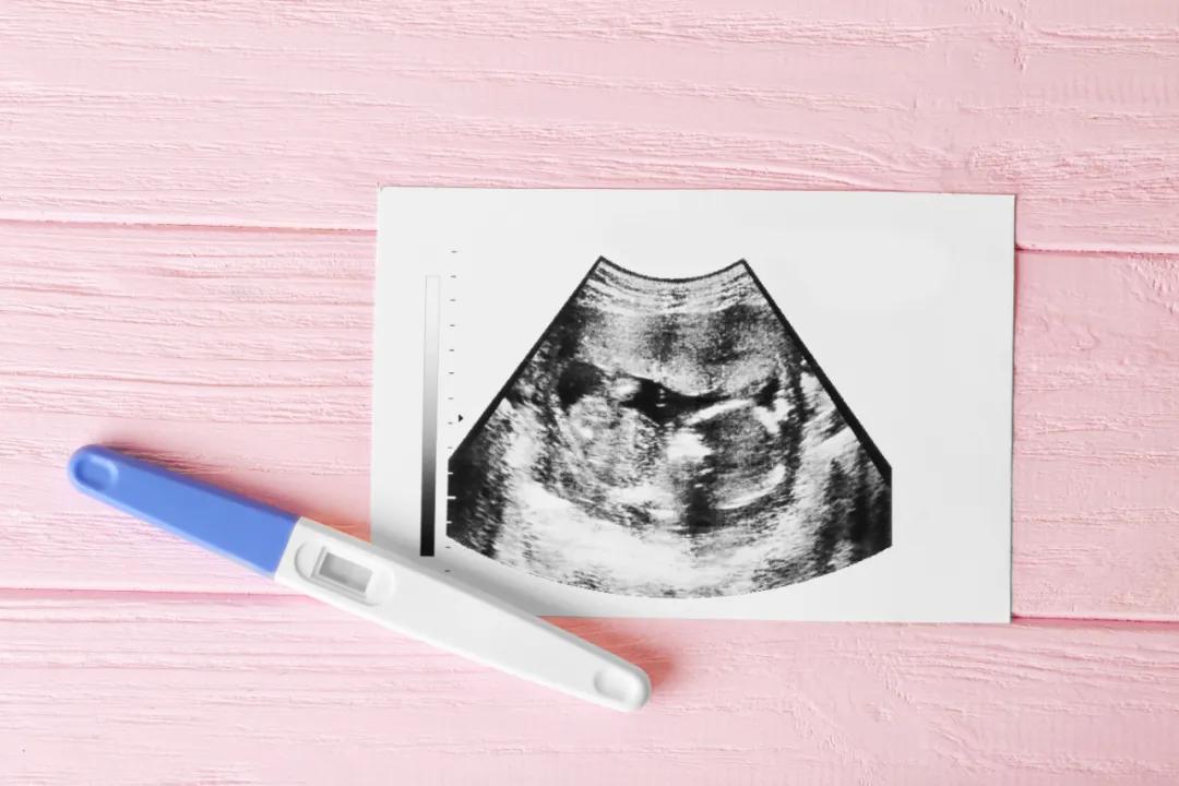 重庆孕妈检查需要多少钱,重庆产检费用