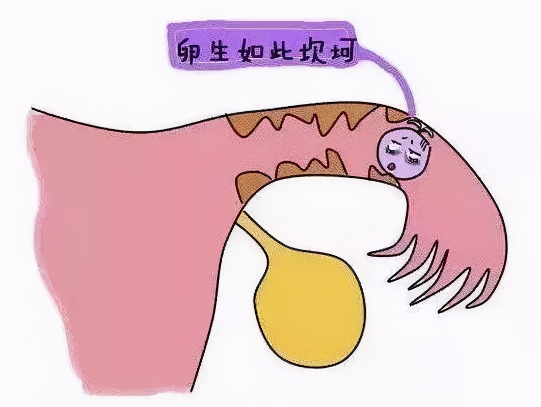 输卵管通而不畅能自然怀孕吗,输卵管通而不畅一次就中怀孕秘诀