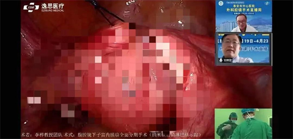 “泰崂巅峰妇有乾坤开拓创新共创辉煌”——记*安泰**市中心医院肿瘤妇科手术直播活动