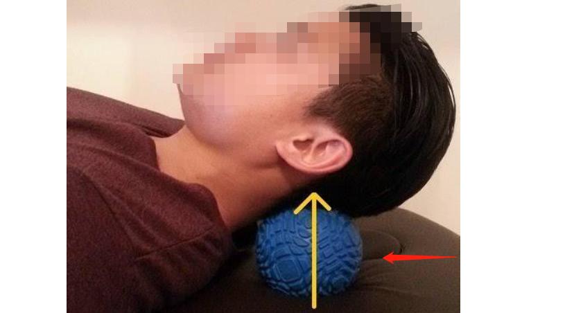 脖子后边的富贵包该怎么治疗,脖子后面的富贵包咋治呢