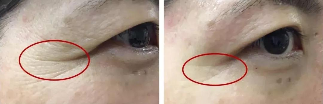 虾青素推荐新西兰,平价虾青素抗老精华