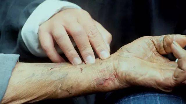 中医治疗新冠肺炎的效果最新,中医治疗新冠肺炎的有效方法