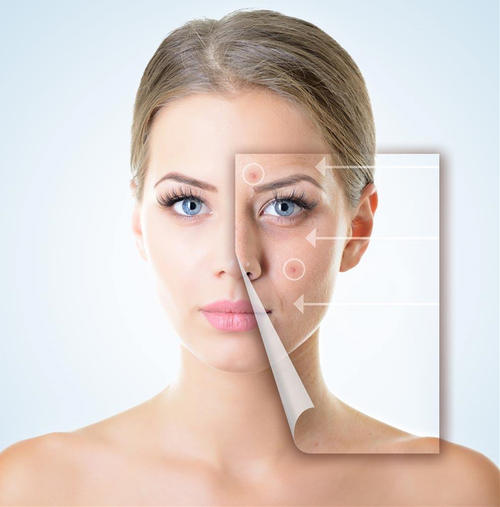 比较快速有效的祛痘印方法,教你一招快速祛痘印