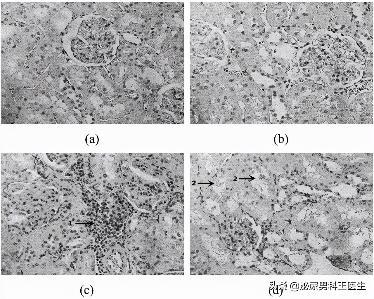 尿酸高身体会出现哪些症状,尿酸高怎么调理下来还需要吃药