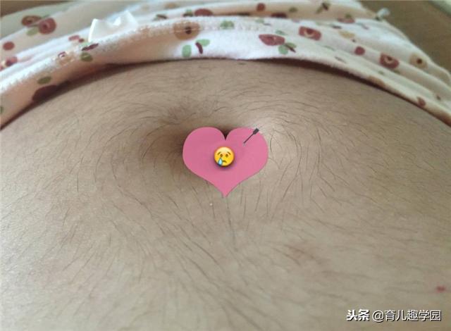 怀孕了肚子长毛是什么征兆,怀孕期间肚子长毛是什么原因