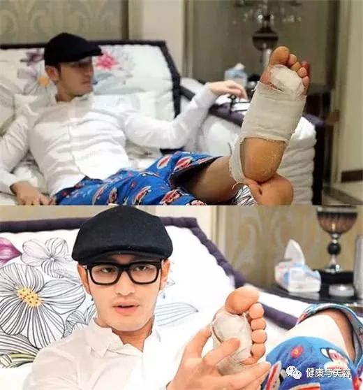 黄晓明谈身高被攻击,黄晓明的脚是如何康复的