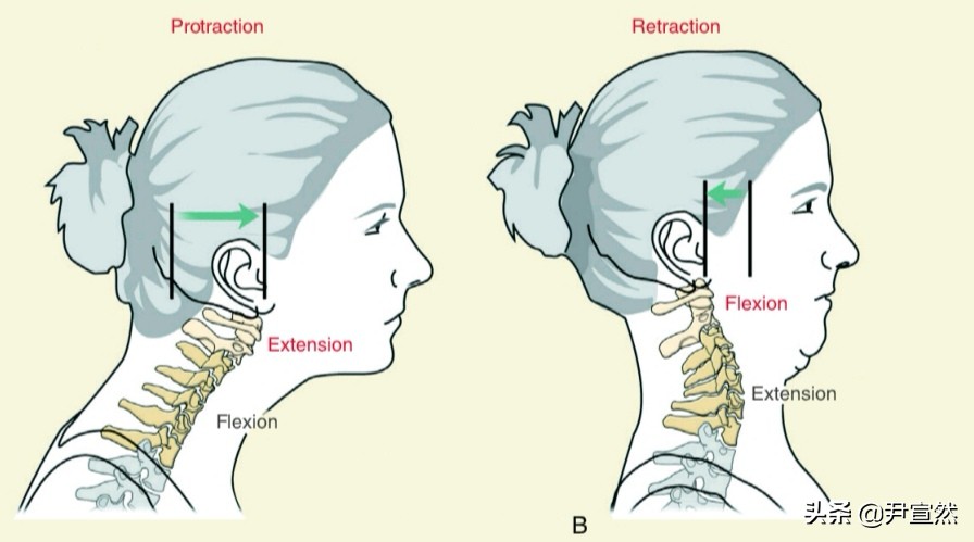 怎么改善头前倾的体态,改善头前倾的动作最有效