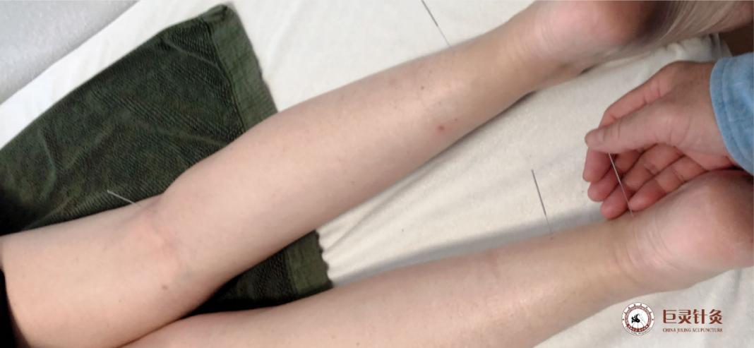 经期偏头痛发作停经,月经期间头晕有血块腰疼用什么药