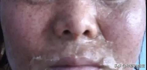 美容养生灌肤,美容灌肤正确方法步骤